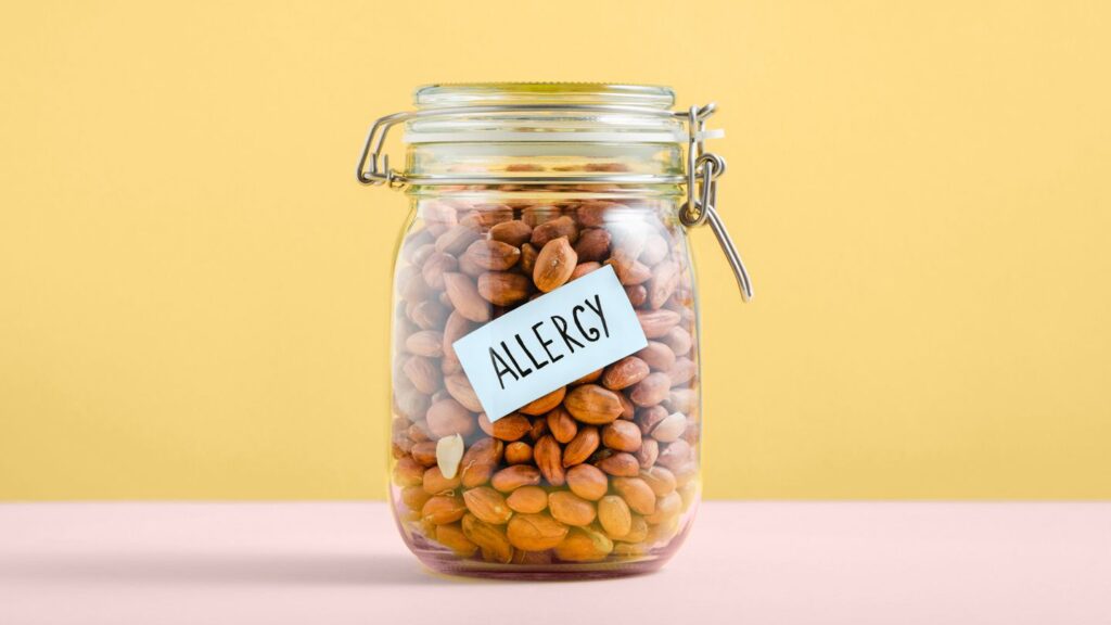 5 Ways to Help Your Child Cope Peanut Allergy and Anxiety: 5 Tips for Helping Your Child Cope