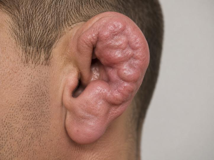 Permanent Injuries Have Become The Newest Symbol of Manhood Online Permanent Injuries Have Become The Newest Symbol of Manhood Online