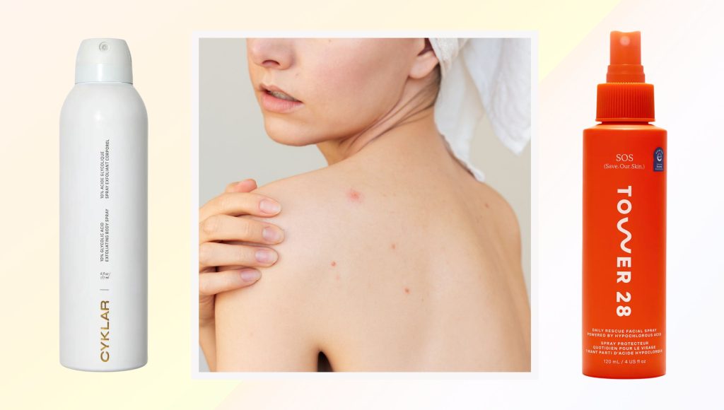 The 10 Best Body Acne Products According to Dermatologists The 10 Best Body Acne Products According to Dermatologists
