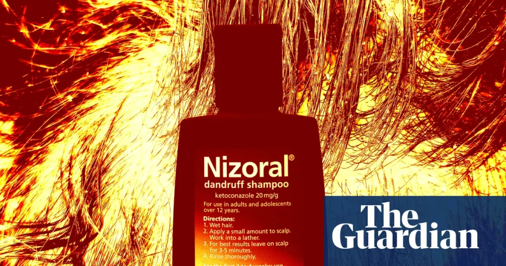Not glamorous, but common: how to manage dandruff at home and when to get help | Well actually Not glamorous, but common: how to manage dandruff at home and when to get help | Well actually